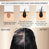 Kormesic 5% Minoxidil With Biotin Hair Regrowth Serum - 30ml