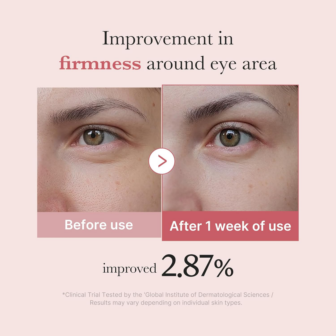 Medicube PDRN Pink Peptide Eye Cream - 30ml