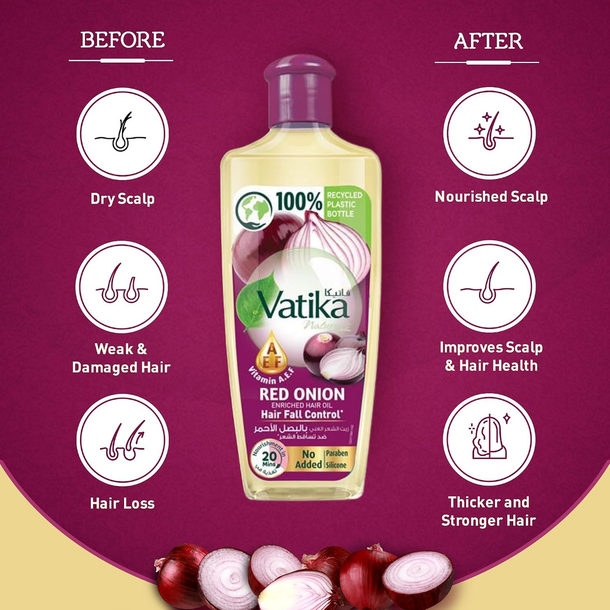 Vatika Red Onion Hair Fall Control Hair Oil - 200ml