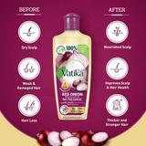 Vatika Red Onion Hair Fall Control Hair Oil - 200ml