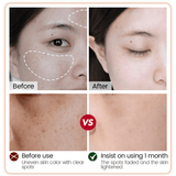 سيروم التبييض α-Arbutin من Vibrant Glamour مع النياسيناميد لتقليل البقع الداكنة - 30 مل