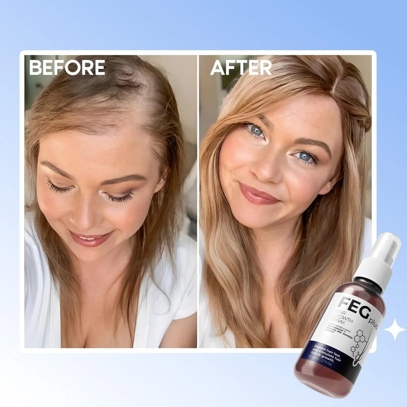 FEG Plus Hair Growth Spray Prevent Hair Loss - 50ml