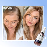 FEG Plus Hair Growth Spray Prevent Hair Loss - 50ml
