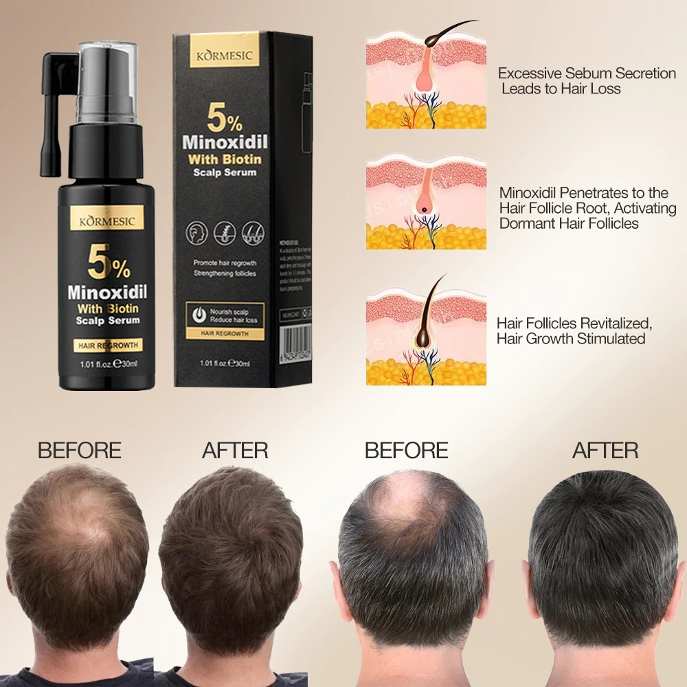 Kormesic 5% Minoxidil With Biotin Hair Regrowth Serum - 30ml