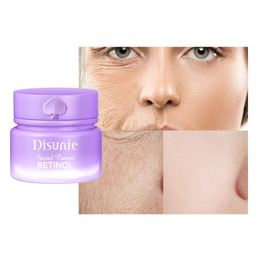 Disunie Anti Aging Retinol Facial Cream - 50g