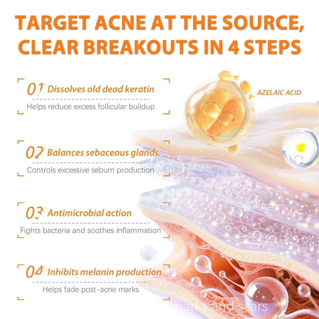 Skinoren Azelaic Acid 20% Anti-Acne Cream - 30g