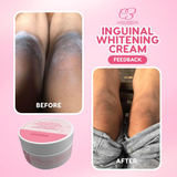 Clarity Essentials Inguinal Brightening Cream - 25g
