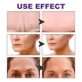 EELHOE Facial Wrinkle Patch Lifting & Firming Facial Skin - 100 Pcs