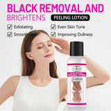 Aichun Beauty Black Removal Brightening Peeling Lotion - 100g