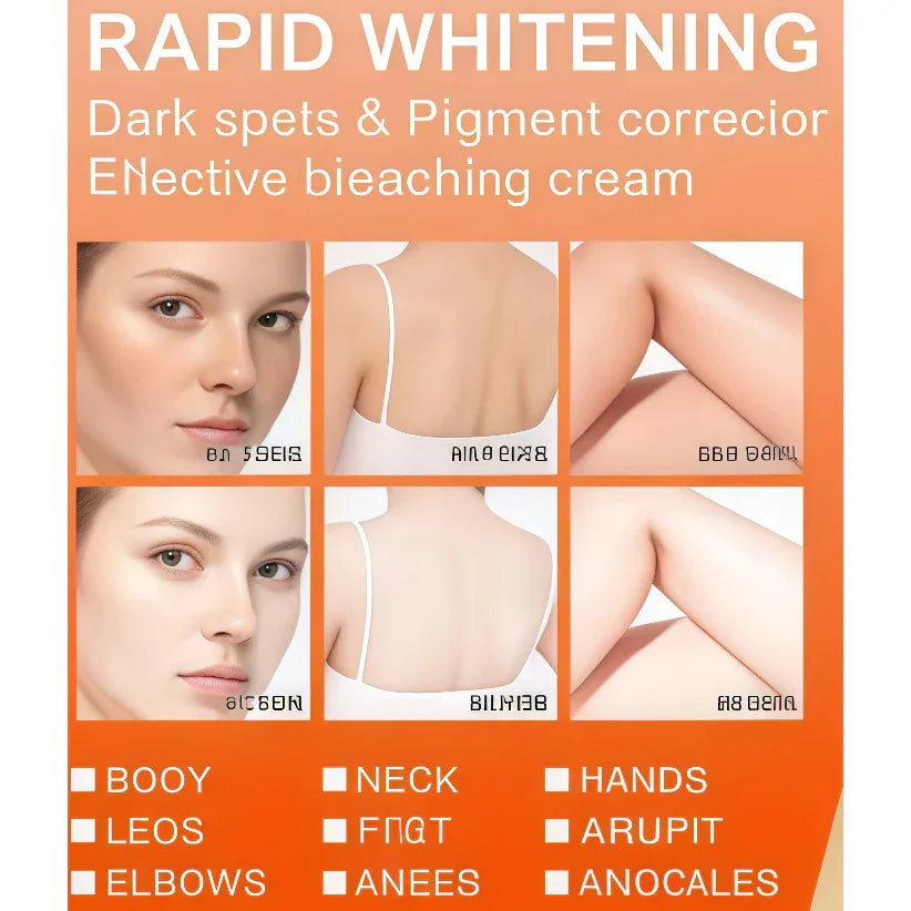 Kiss Beauty Rapid Brightening Complex Cream - 120g