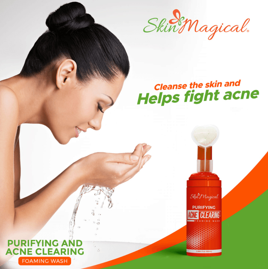 غسول رغوي لتنقية البشرة وإزالة حب الشباب سحريًا - 100 مل