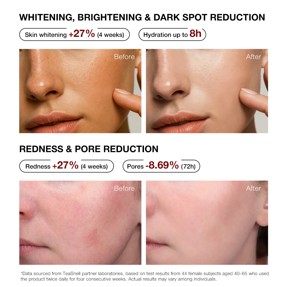 Teashell 5% Niacinamide Brightening Serum - 30ml