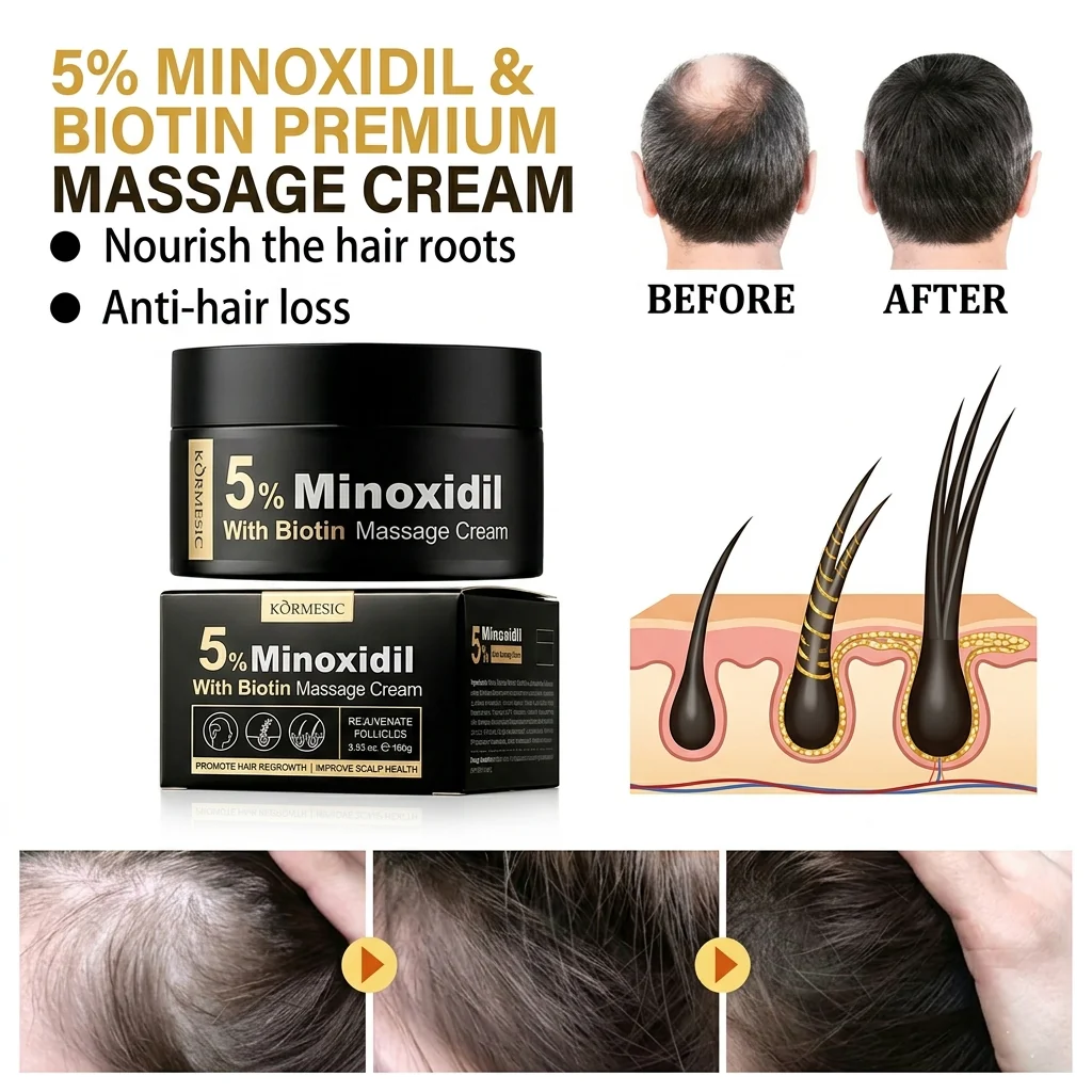 Kormesic 5% Minoxidil With Biotin Hair Massage Cream - 100g