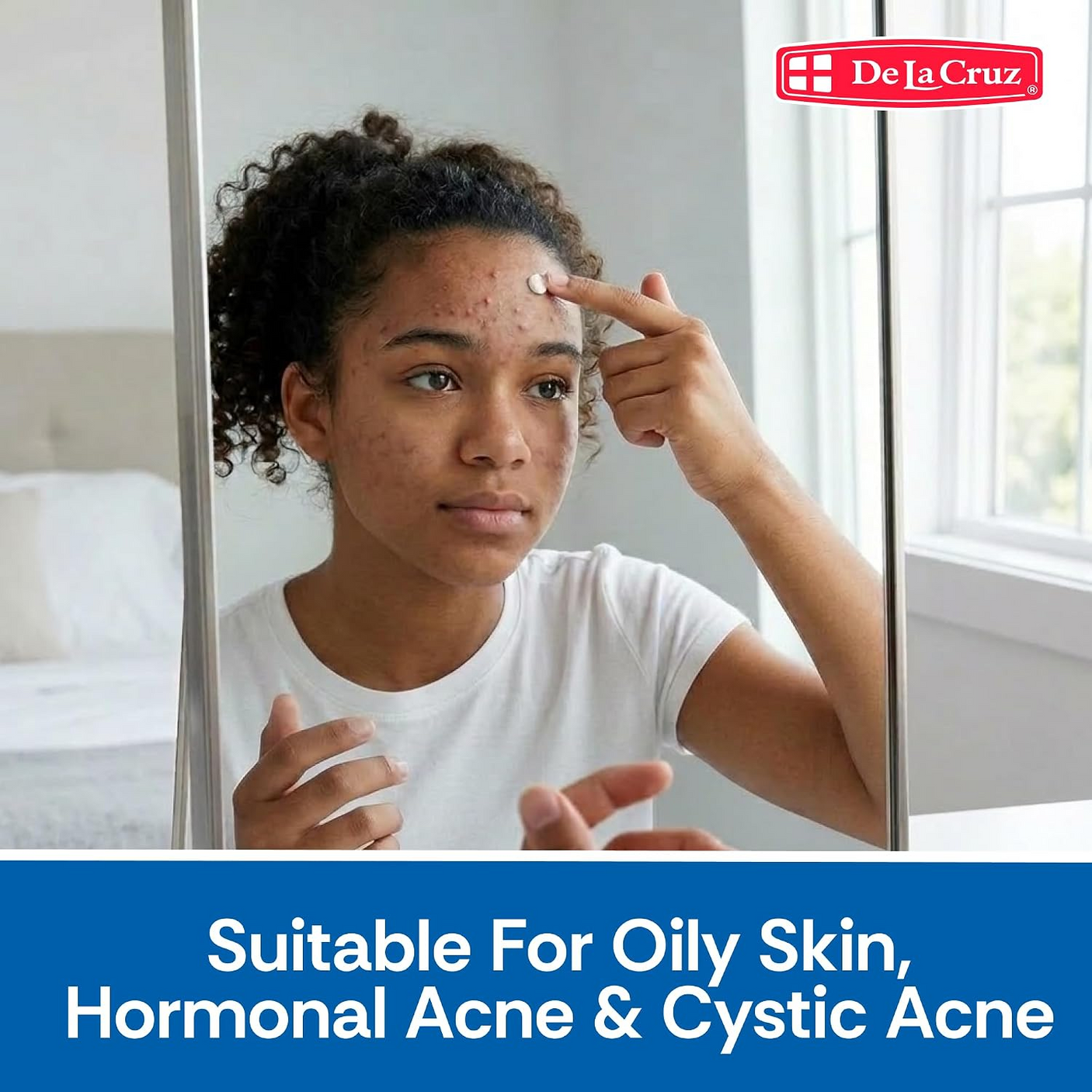 De La Cruz Maximum Strength Acne Treatment - 74g