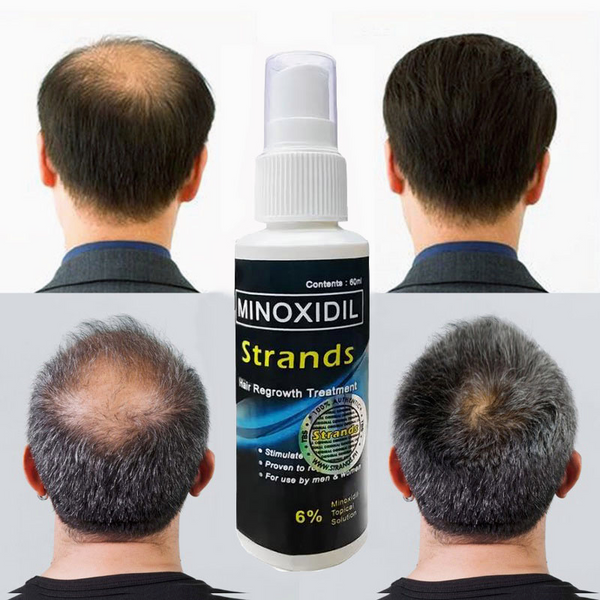 Minoxidil Hair Regrowth Treatment - 60ml