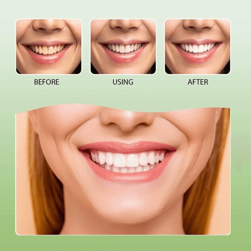 Face U Japan Technology Brightening Toothpaste With Baking Soda - 180g