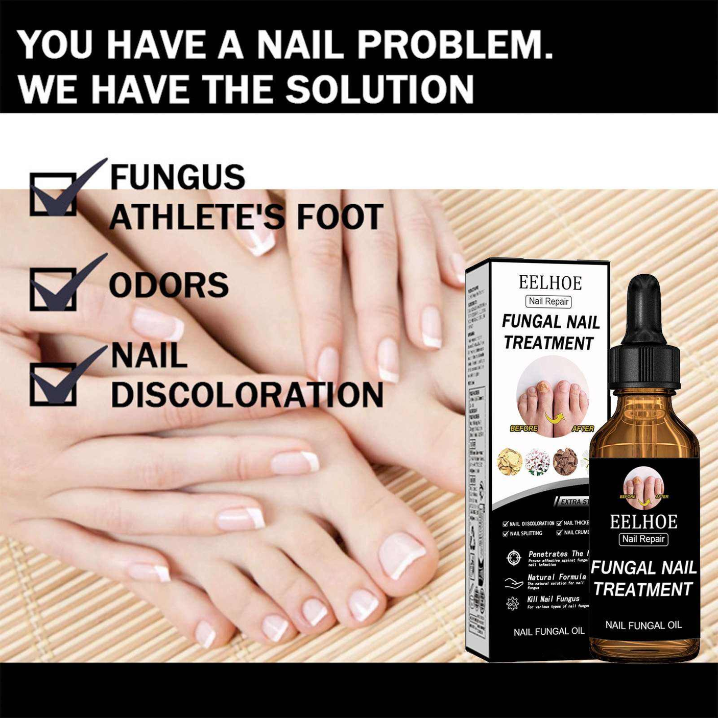 EELHOE Fungal Nail Repair Oil - 50ml