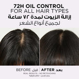 L'Oreal Elvive Hyaluron Pure Shampoo + Conditioner - 400ml + 360ml