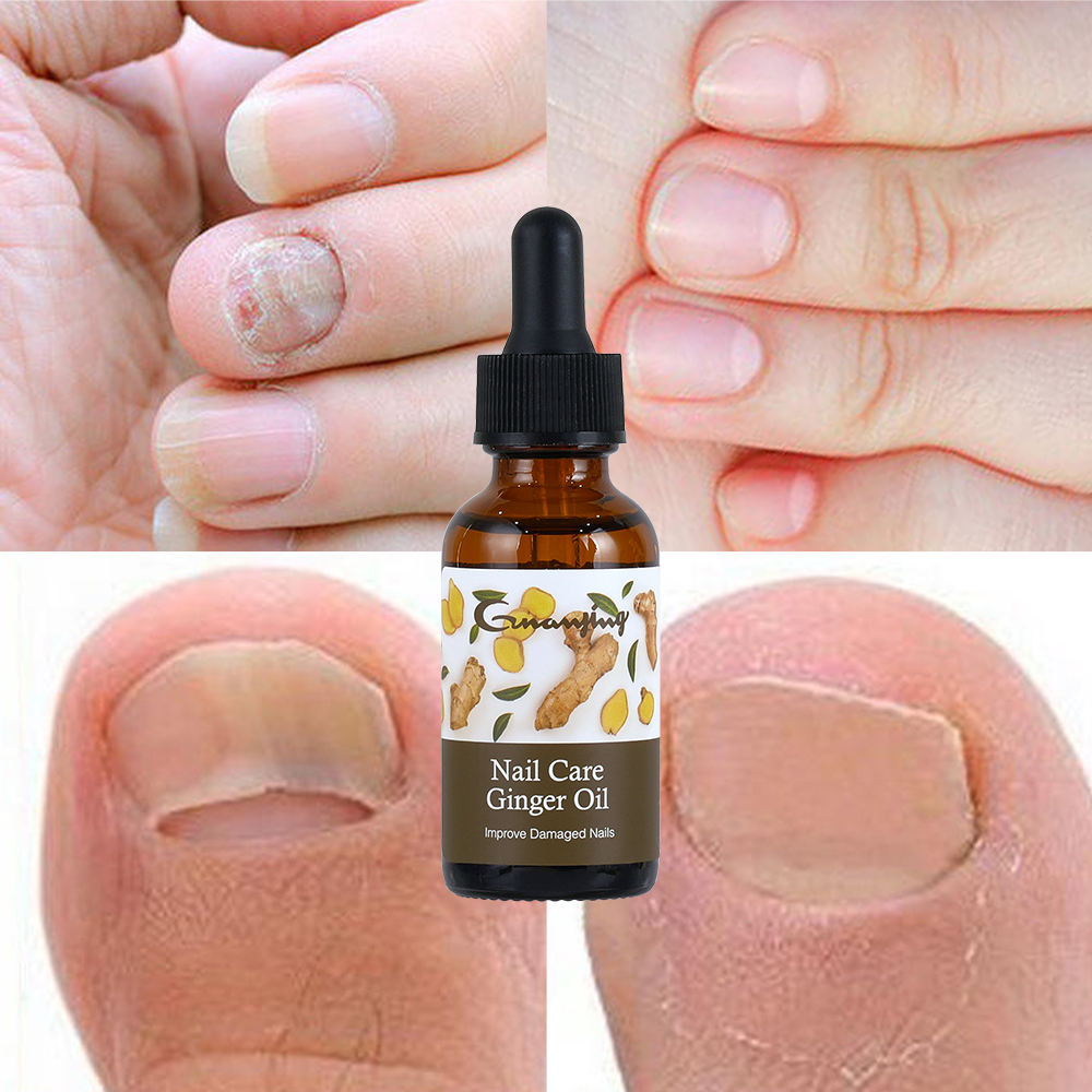 Guanjing Nail Care Ginger Oil Improve Damaged Nails - 30ml