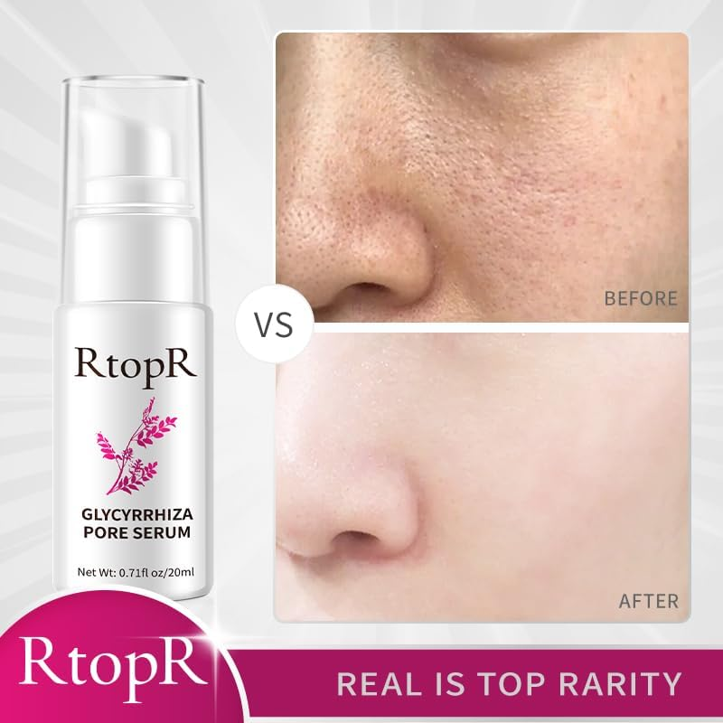 RtopR Glycyrrhiza Pore Face Serum - 20ml