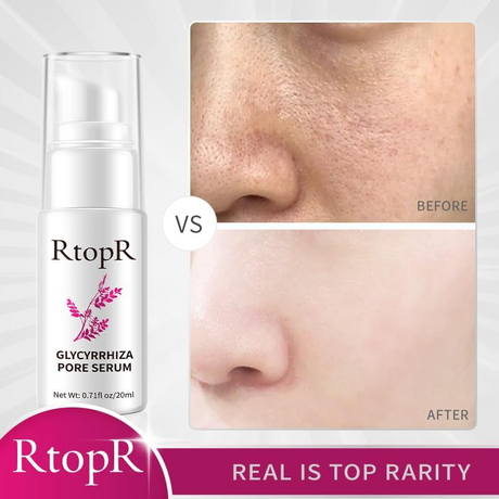 RtopR Glycyrrhiza Pore Face Serum - 20ml