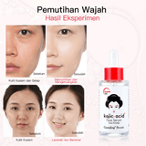 Guanjing Beauty Kojic Acid Anti-Wrinkle Face Serum - 40ml