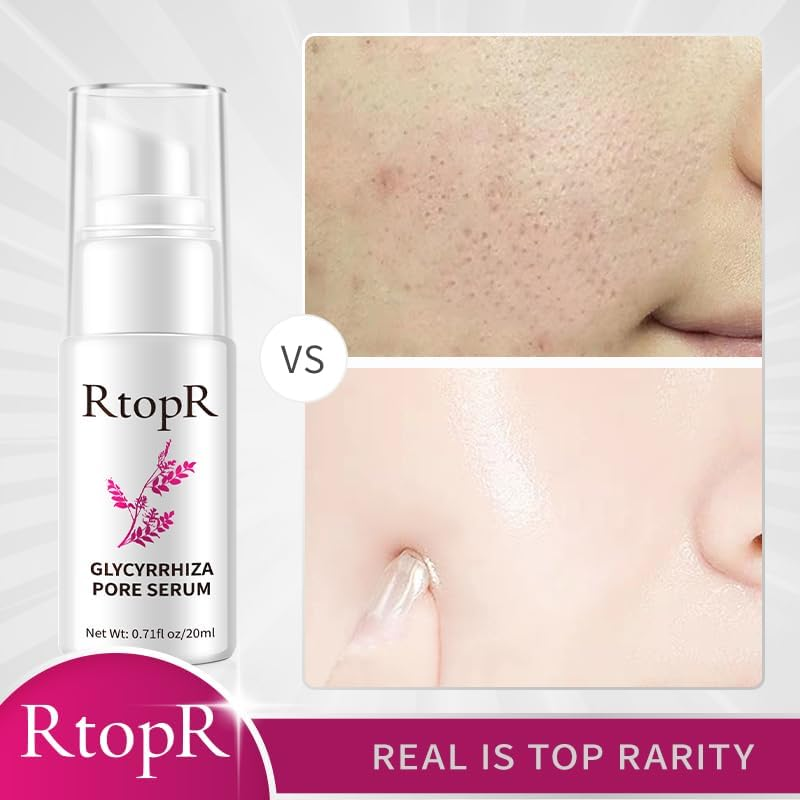 RtopR Glycyrrhiza Pore Face Serum - 20ml