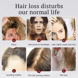 Kormesic 5% Minoxidil With Biotin Conditioner - 300ml