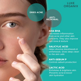 Luxe Organix Miracle Solutions Acne Derm+ Pimple Corrector - 20g