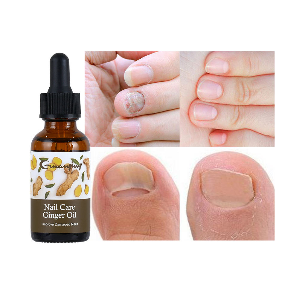 Guanjing Nail Care Ginger Oil Improve Damaged Nails - 30ml