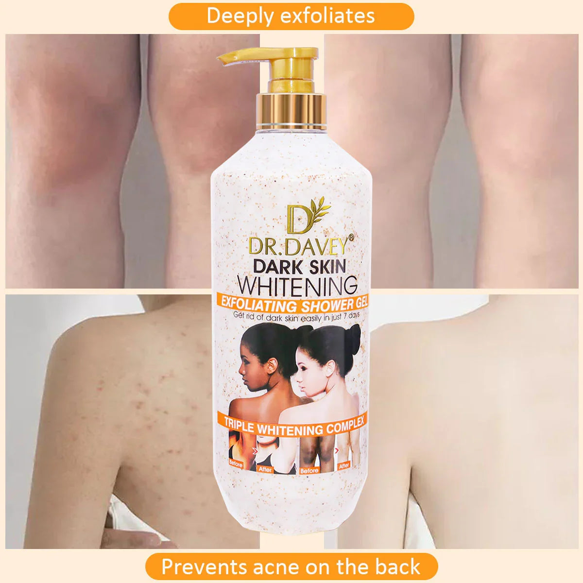 Dr. Davey Dark Skin Brightening Exfoliating Shower Gel - 1000ml