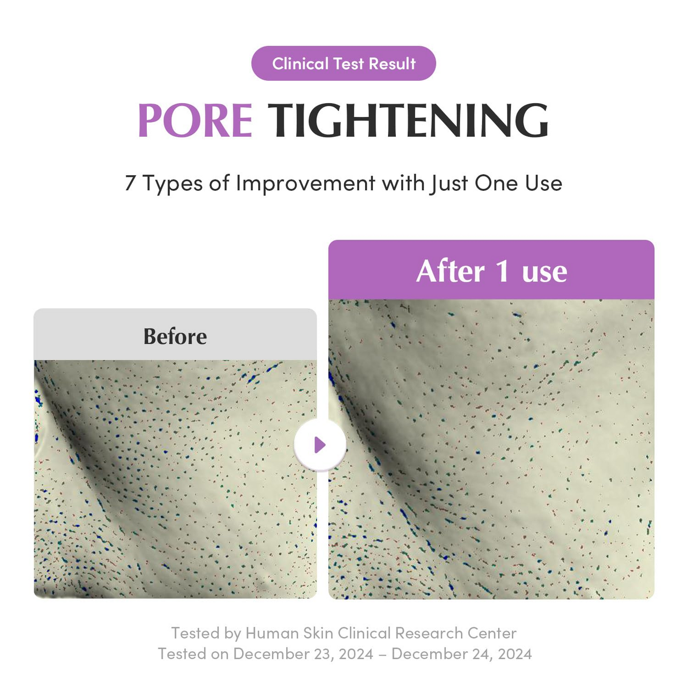 Eqqualberry Purple Rice Pore Purifying Pack Cleanser - 130g