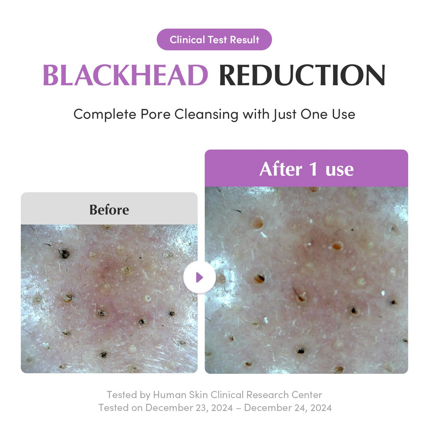 Eqqualberry Purple Rice Pore Purifying Pack Cleanser - 130g