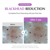 Eqqualberry Purple Rice Pore Purifying Pack Cleanser - 130g