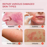 Sumifun Calamine Eczema Relief Cream - 20g