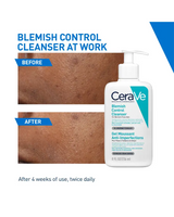 CeraVe Blemish Control Facial Cleanser - 236ml