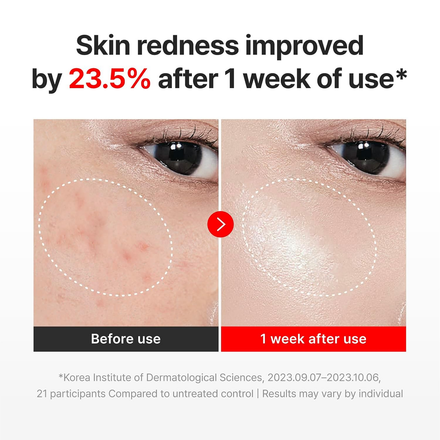 Centellian 24 Madeca Cream Time Reverse Face Cream - 50ml