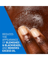 CeraVe Blemish Control Facial Cleanser - 236ml