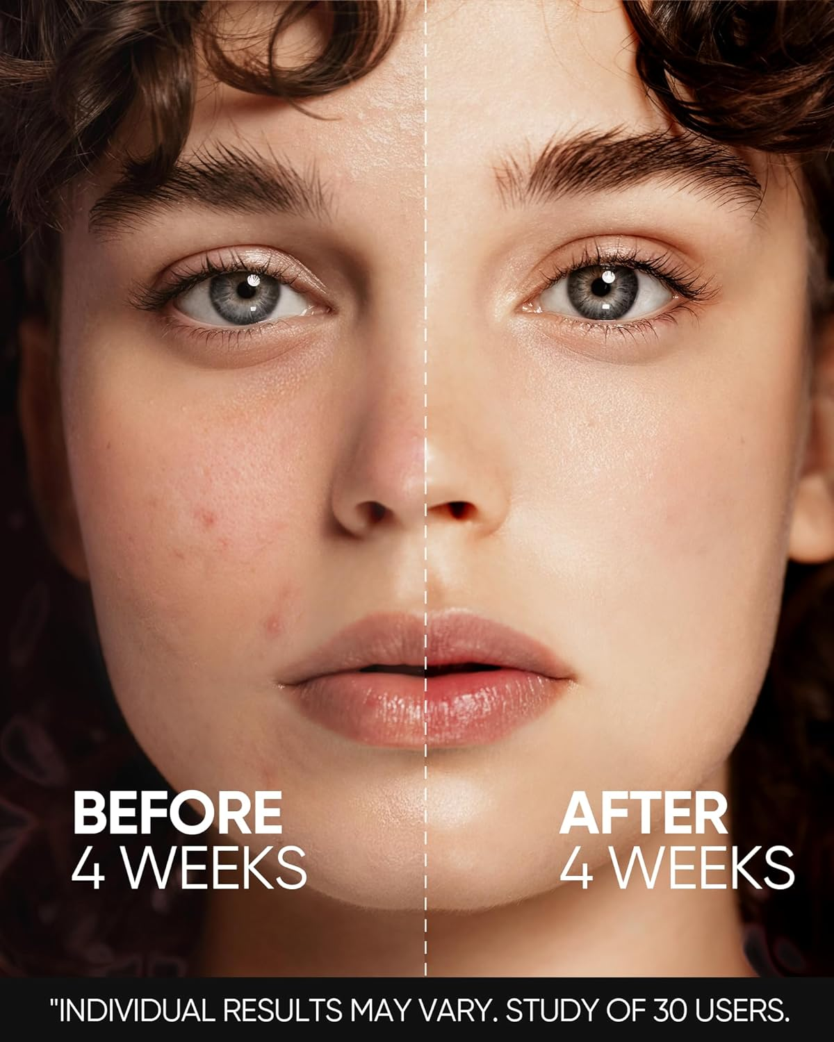 SKINTIFIC Retinol Skin Renewal Serum - 20ml