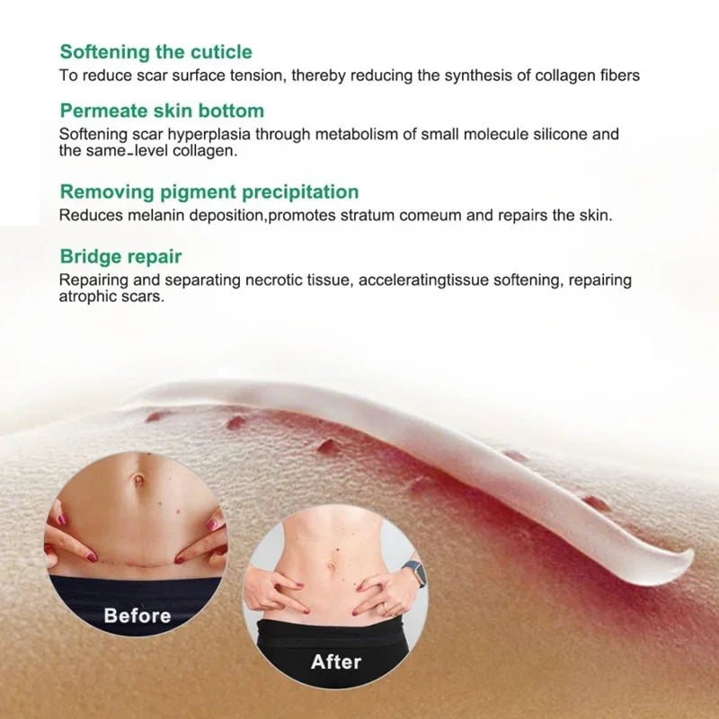 Maycheer Scar Repair & Reduce Cream - 50g