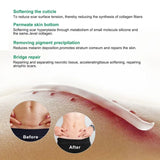Maycheer Scar Repair & Reduce Cream - 50g