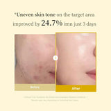Sadoer Kojic Acid Turmeric Collagen Peel-Off Facial Mask - 75ml