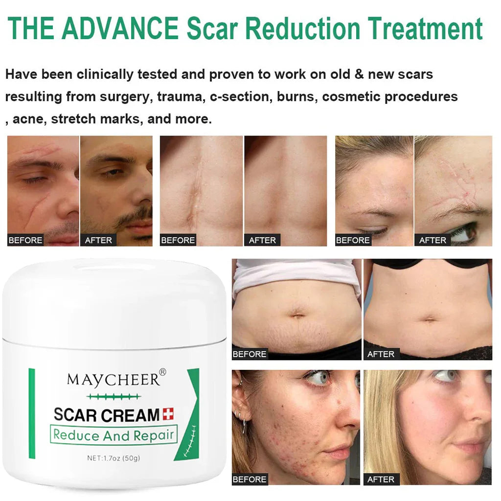 Maycheer Scar Repair & Reduce Cream - 50g