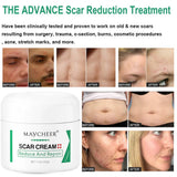 Maycheer Scar Repair & Reduce Cream - 50g