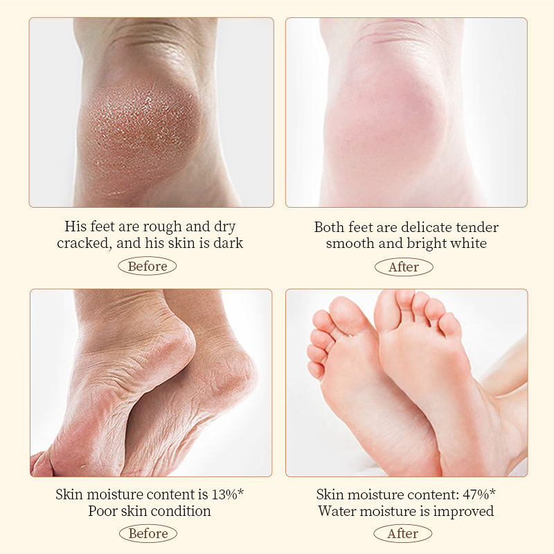 Sadoer Anti-Cracking Hand & Foot Cream With Shea Butter - 60g