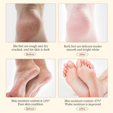 Sadoer Anti-Cracking Hand & Foot Cream With Shea Butter - 60g