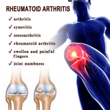 South Moon Joint Pain Relieves Rheumatoid Arthritis Miracle Cream - 20g