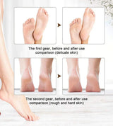 Portable Electric Pedi Callus Remover XG-P8020