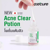 Oxecure Acne Clear Potion - 15ml