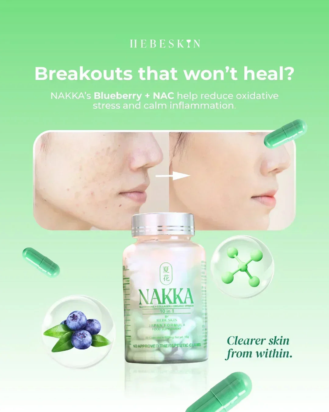 Hebeskin Nakka 10 in 1 Glutathione - 30s (Japan Formula)